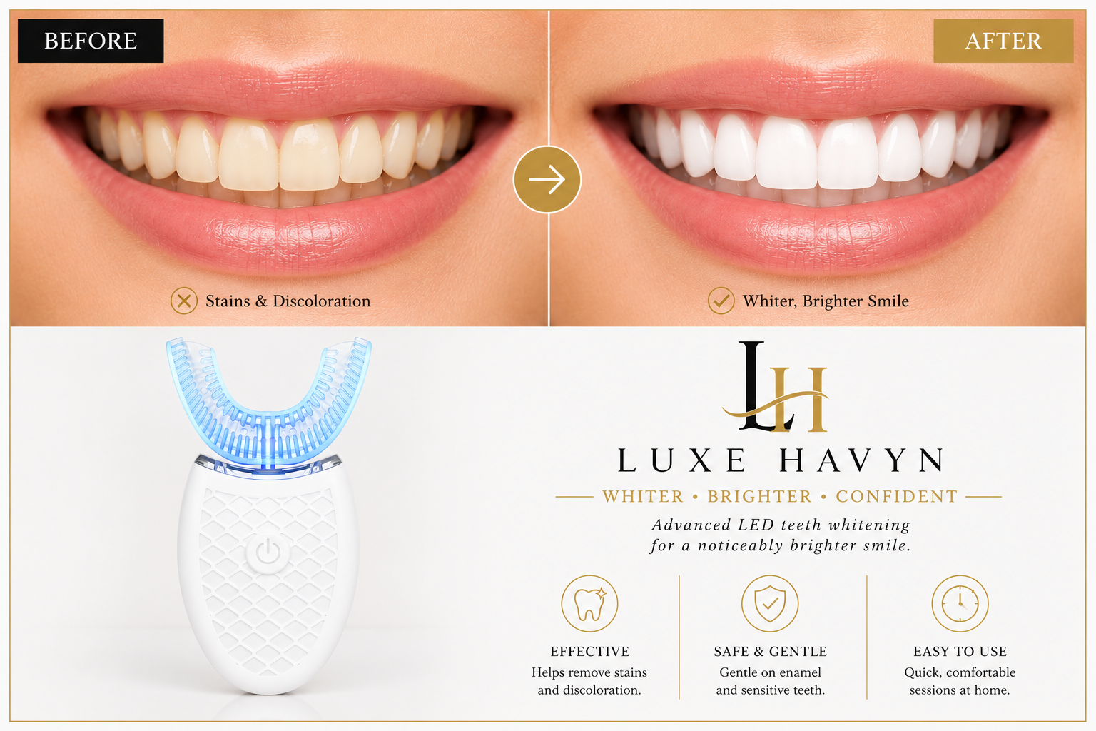 360° Sonic Toothbrush – Deep Cleaning U-Shaped Electric Toothbrush